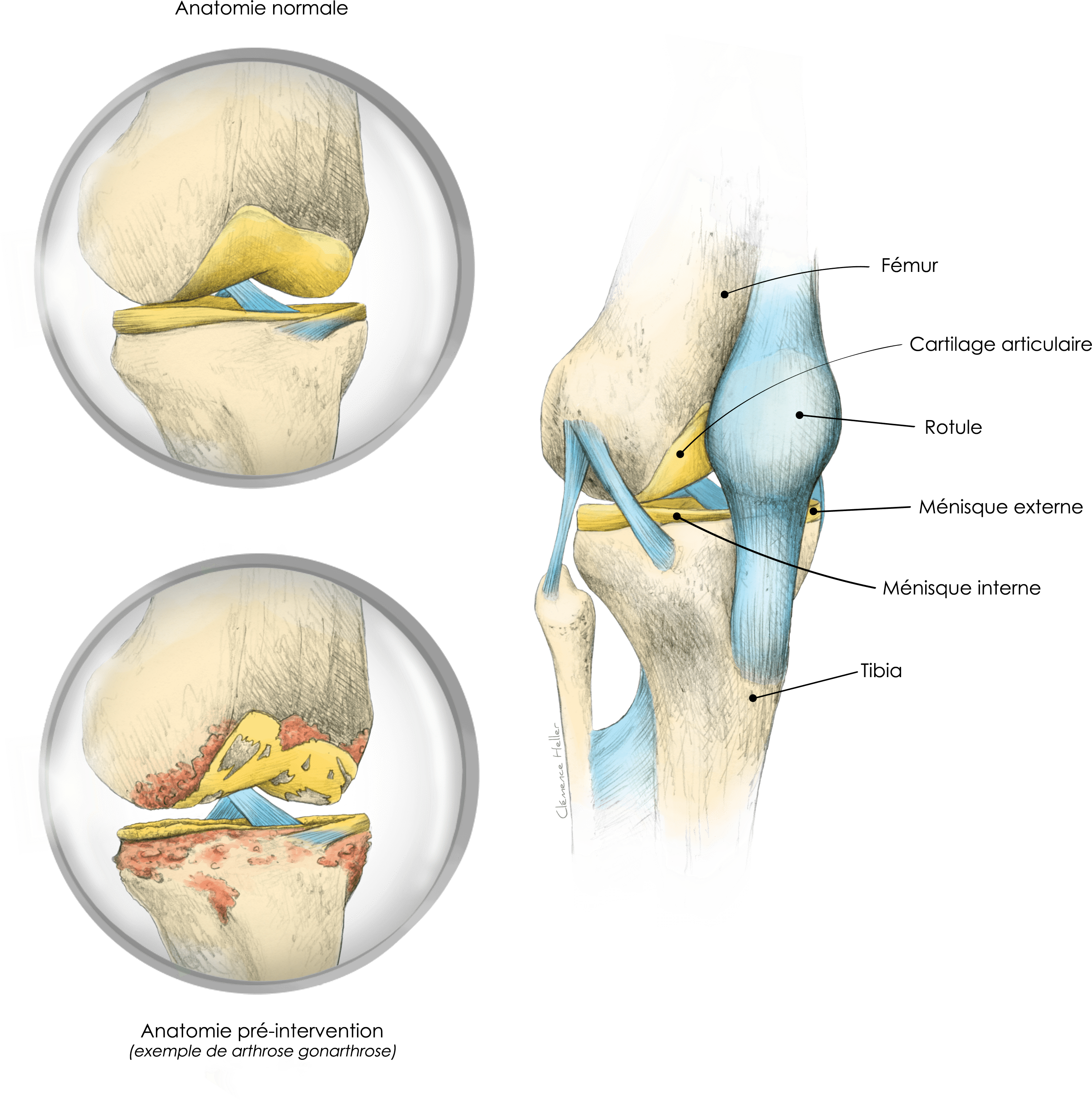 Chirurgie orthopédique et traumatologique - genou anatomie
